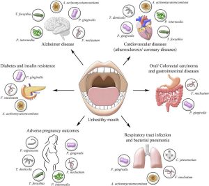 What Is SimplyPerio Saliva Testing and How Does It Work?