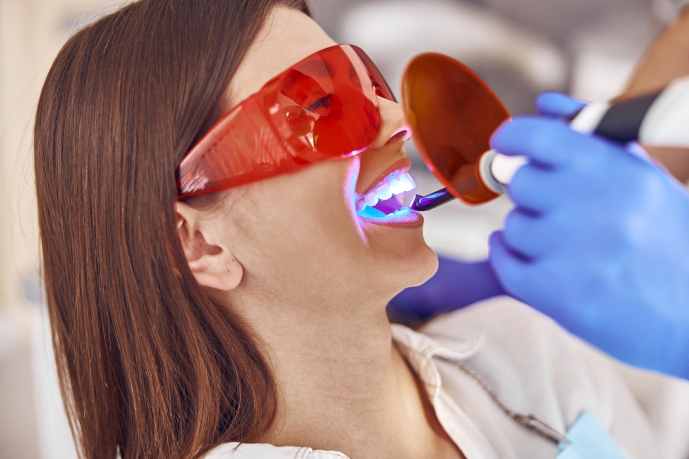 how to maintain white teeth after whitening treatment